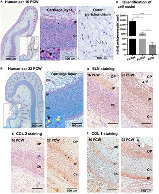 Modeling Normal and Pathological Ear Cartilage in vitro Using Somatic Stem Cells in Three-Dimensional Culture